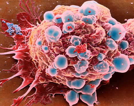 Давайте познакомимся с раковыми клетками поближе